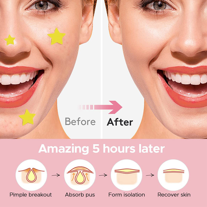 600Pcs/set Star Pimple Patch A - Beauty For Makeup 评论和价格